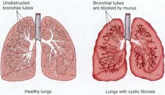 (Photo: Humanillness.com)